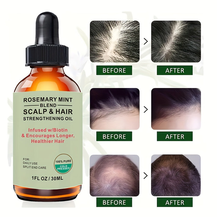 Rosemary Mint Scalp & Hair Strengthening Oil With Biotin & Essential Oils, Hair Care Essential Oil For Split Ends And Dry Scalp For All Hair Types, 30ml/1.01 Fl Oz