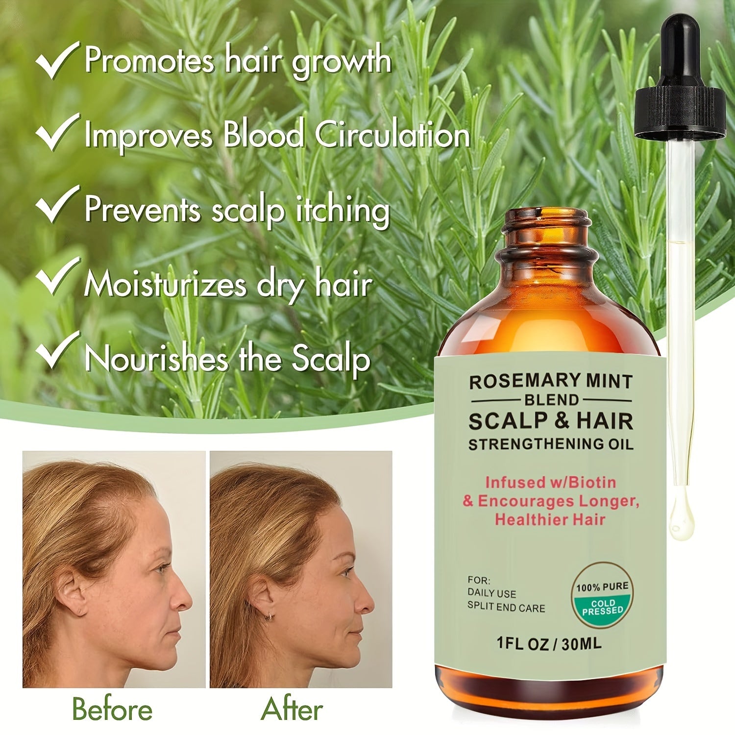 Rosemary Mint Scalp & Hair Strengthening Oil With Biotin & Essential Oils, Hair Care Essential Oil For Split Ends And Dry Scalp For All Hair Types, 30ml/1.01 Fl Oz